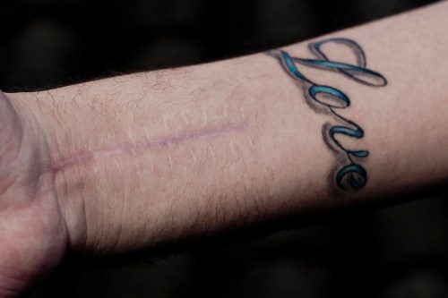 Only Love can heal such a scar | Atibaia | Jaime Scatena (F.Migliano)