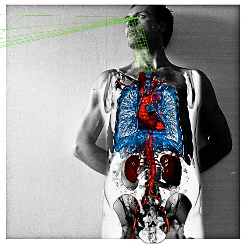 eating that stuff will damage my insides | London | R.Cambusano